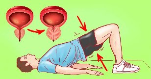 Ejercicio para la prostatitis