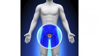 prostatitis en un hombre