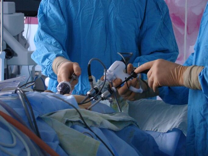 tratamiento quirúrgico de la prostatitis