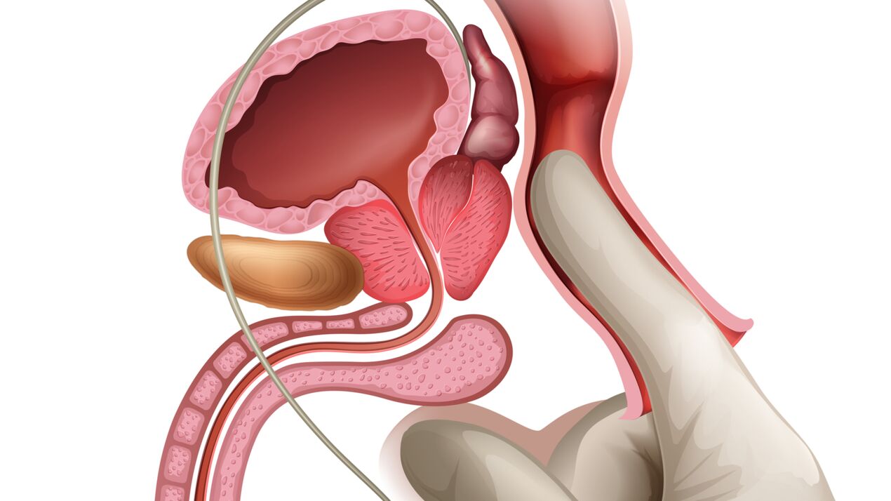 El masaje de próstata es una forma eficaz de tratar la prostatitis congestiva