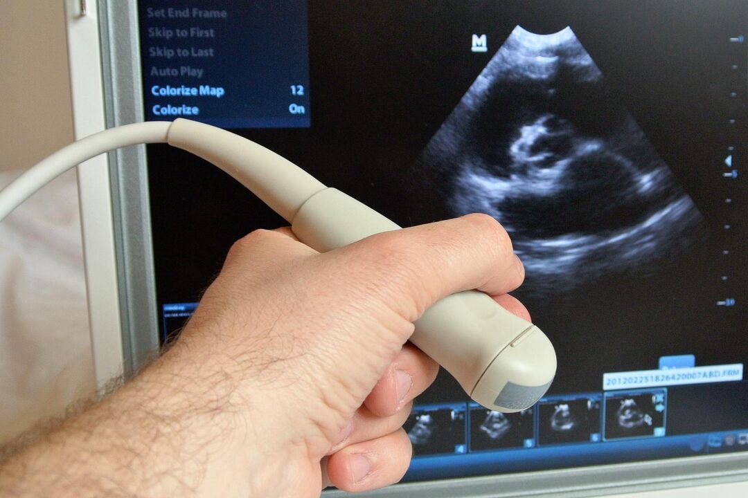 La ecografía ayudará a diagnosticar la prostatitis congestiva en un hombre. 