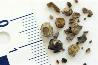 piedras
